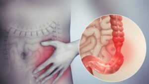 Auf dem Bauch einer Person ist ein roter Fleck zu sehen.