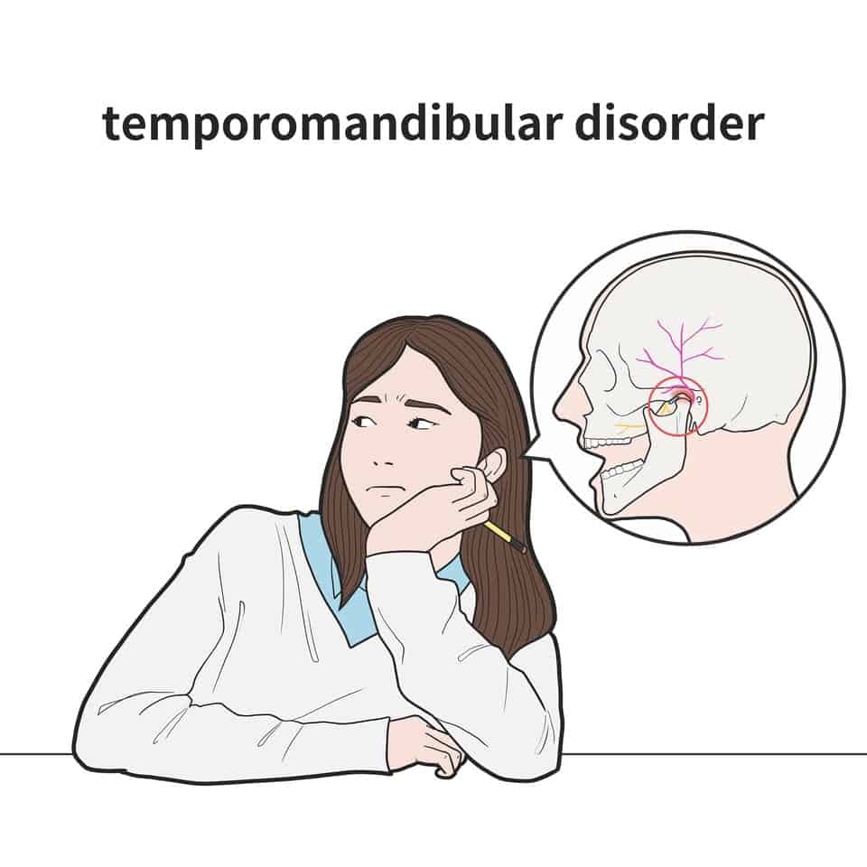 Temporallappenepilepsie ist eine Erkrankung, die durch wiederkehrende Anfälle gekennzeichnet ist, die vom Temporallappen des Gehirns ausgehen.